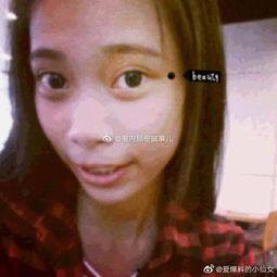 整容网红吃瓜,揭秘网红们的“美丽陷阱”